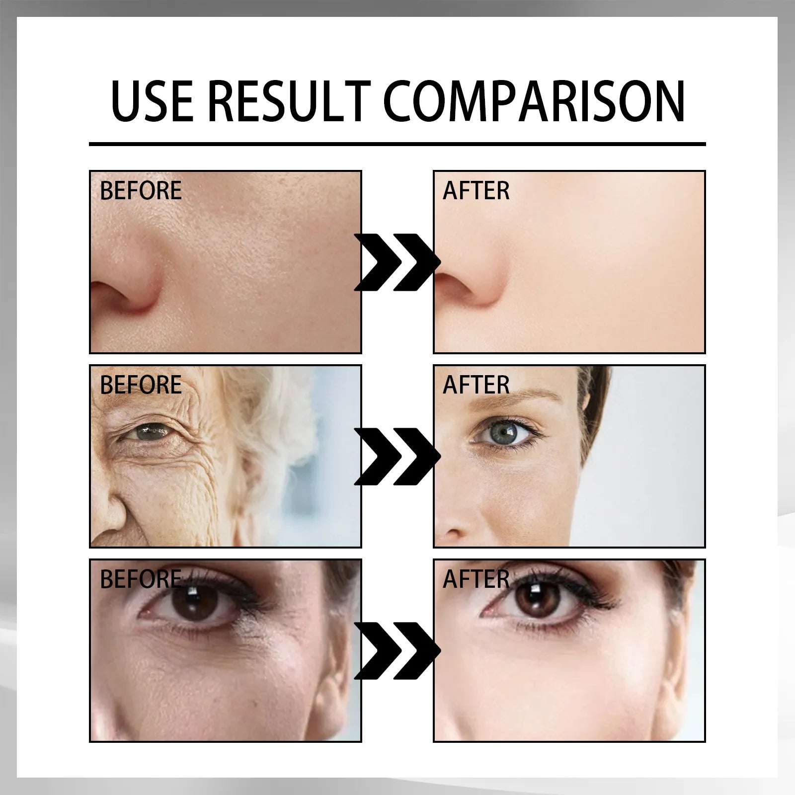 Hydrating Repair Serum — Snail Mucin for Acne-Prone, Barrier-Stressed Skin