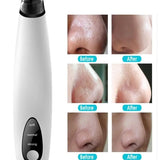 Electric Blackhead Remover Cleaner Face Diamond Pore Vacuum Suction White Heads